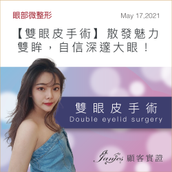 3 則改變人生的迷人故事 散發魅力雙眸，自信深邃大眼！ 專業雙眼皮手術，精準設計專屬美感