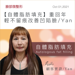 自體脂肪填補手術 – 雕塑曲線，煥發自然美感 重回年輕不留痕，改善凹陷臉！ 